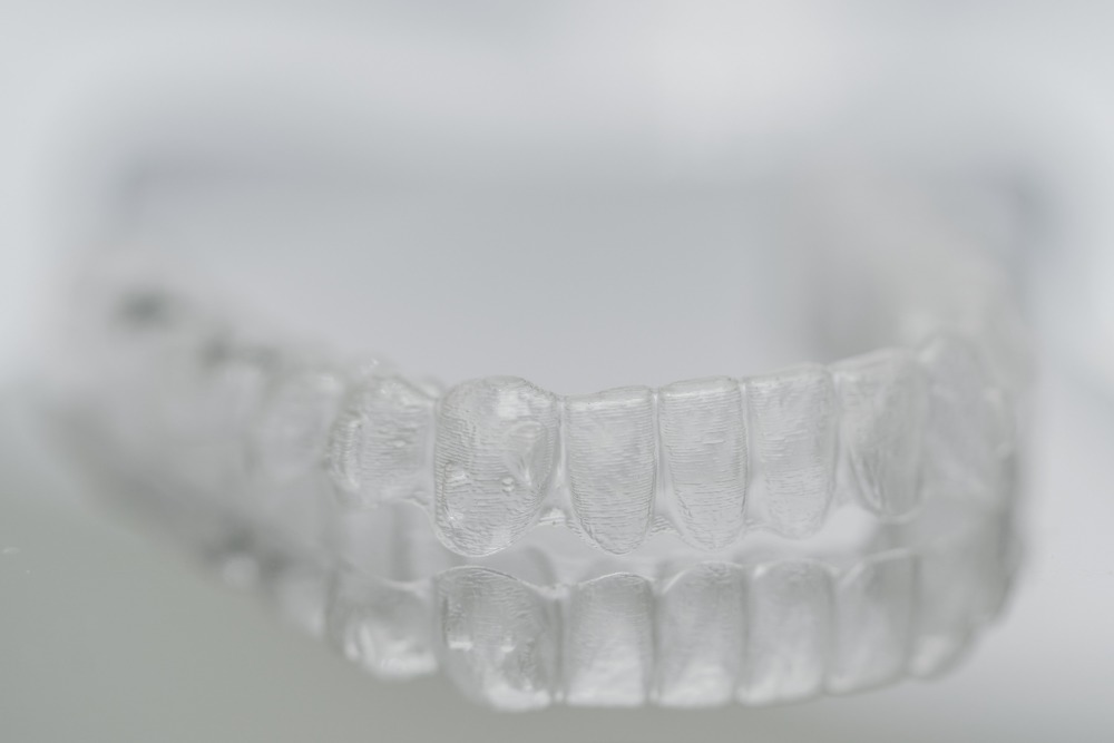 zahnarzt-muenchen-lehel- invisalign-2